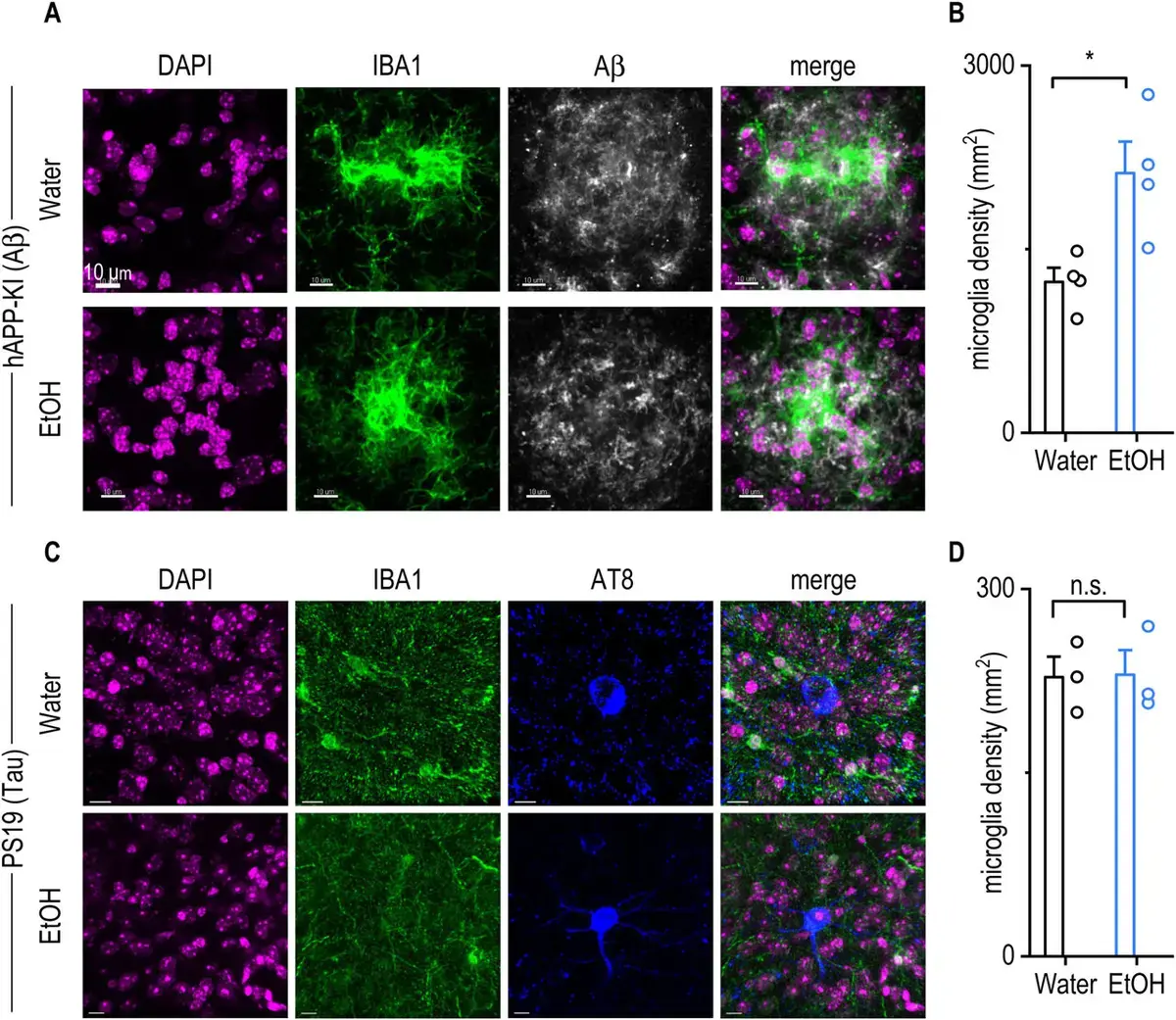 Alcohol's Dual Impact on Alzheimer's Brains Revealed