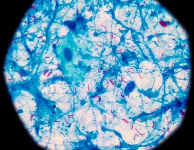 BCG Vaccine Remodels Brain's Immune Environment
