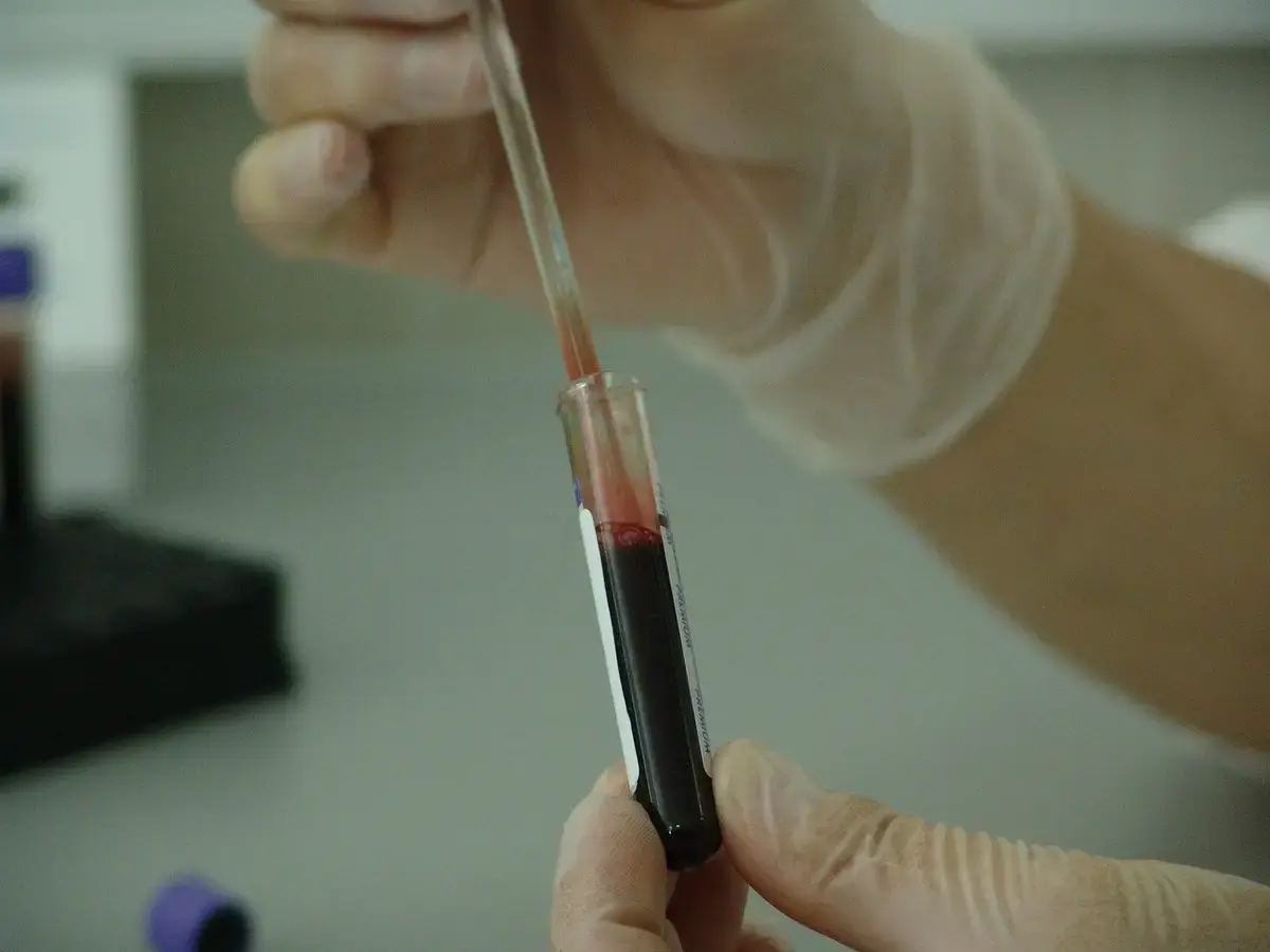 Blood Test May Predict Colorectal Cancer Spread
