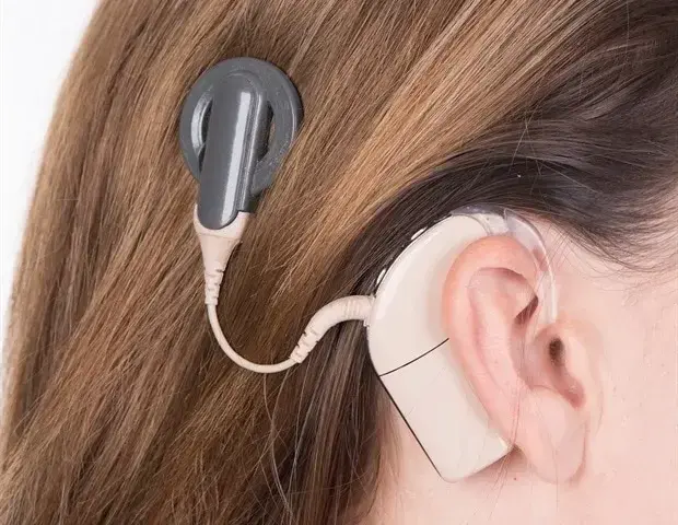Brain's Adaptability Key to Future Cochlear Implant Success