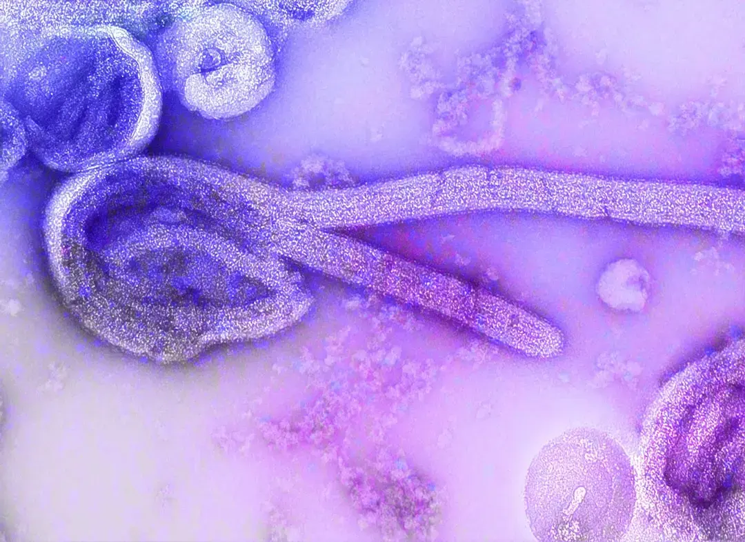 Cyclospora Outbreak Linked to Widespread Food Contamination