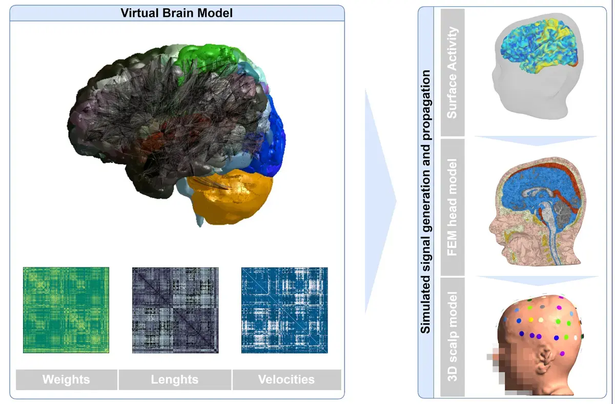 Digital Brain Twin Recreates Brain Activity in Toddler with Autism