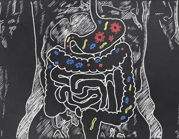 Gut Microbiome Changes Persist After Polyp Removal