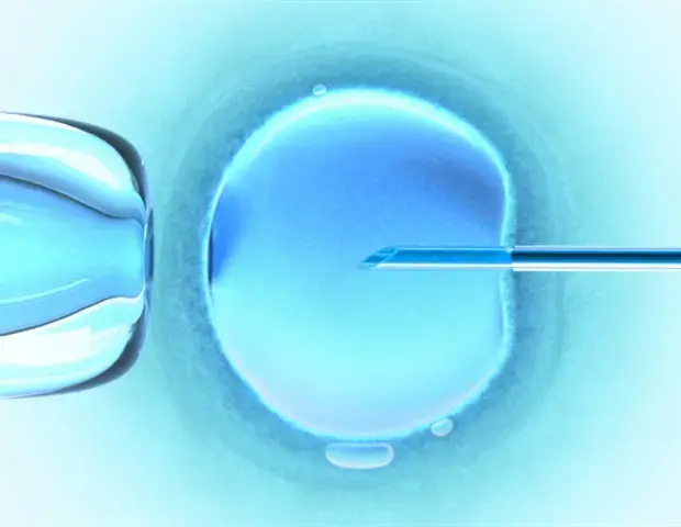 Infertility Linked to Earlier Menopause