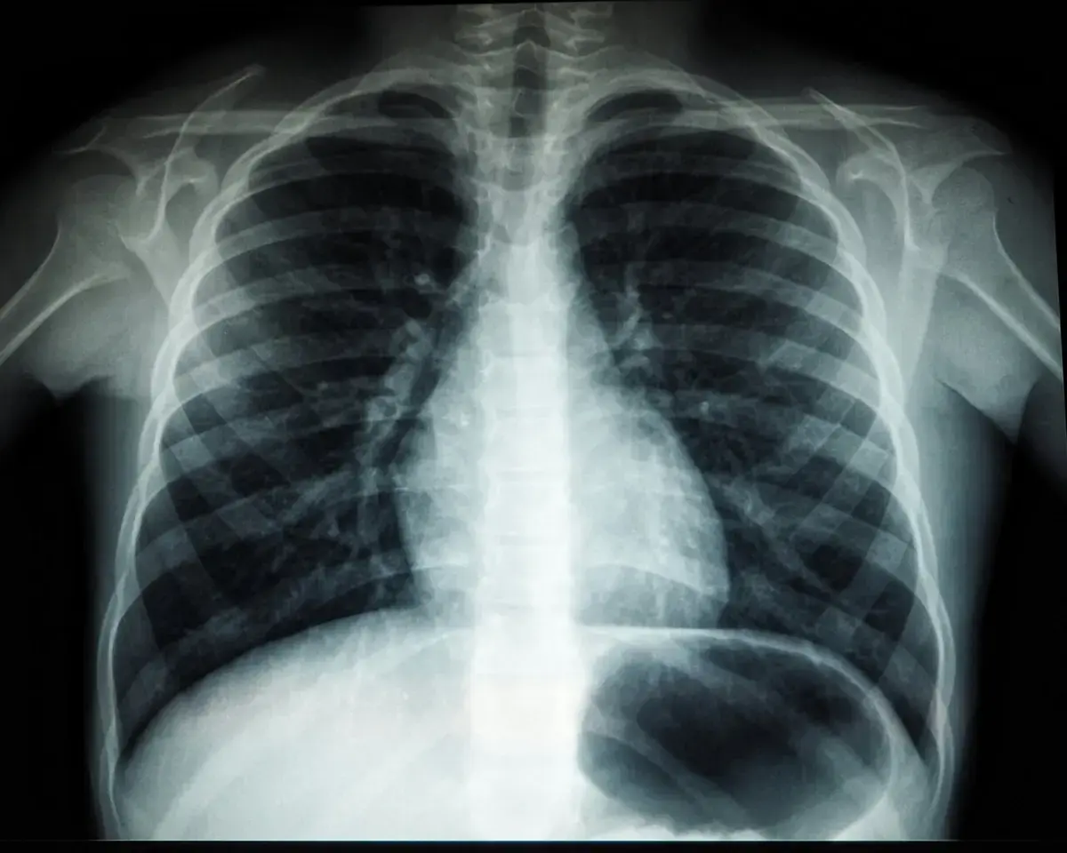 Light‑Activated Switch Forces Dormant Lung Cancer Cells to Re‑Enter Growth Cycle