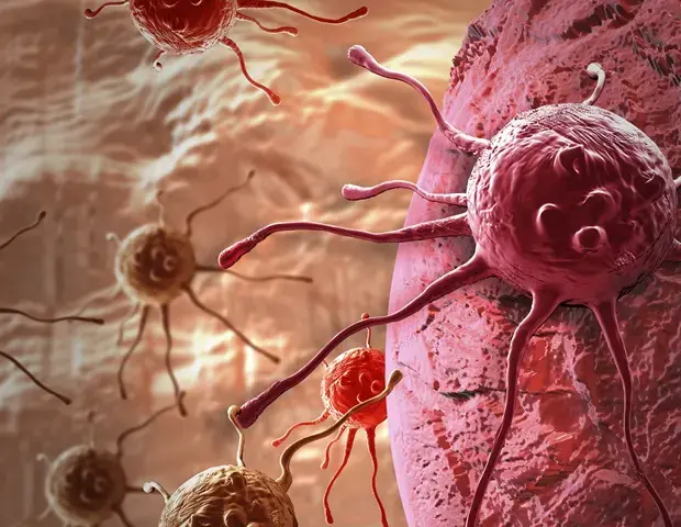 Long-Term Cancer Risks in Survivors Uncovered