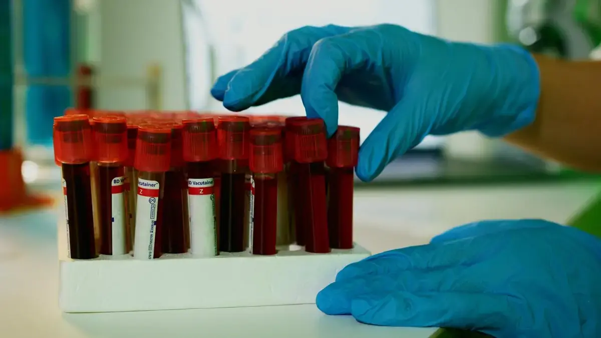 Many Americans Without Heart Disease Fail to Meet New Cholesterol Targets