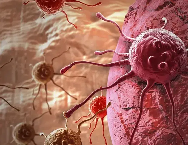 New Ultrasound Method May Boost CAR-T Therapy for Solid Tumors