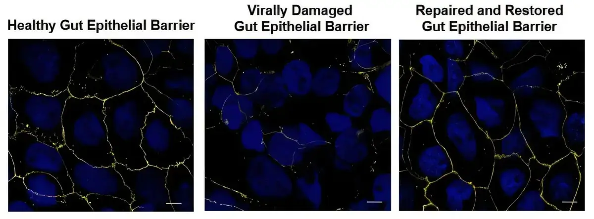 Probiotic Compound Shows Promise in HIV Treatment