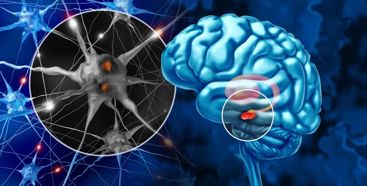 Sleep Patterns May Predict Parkinson's Disease Risk