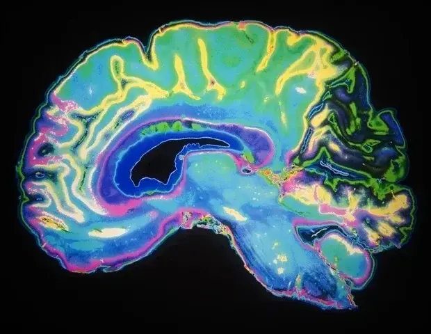 Unexpected discovery points to a possible route for childhood brain tumor treatments