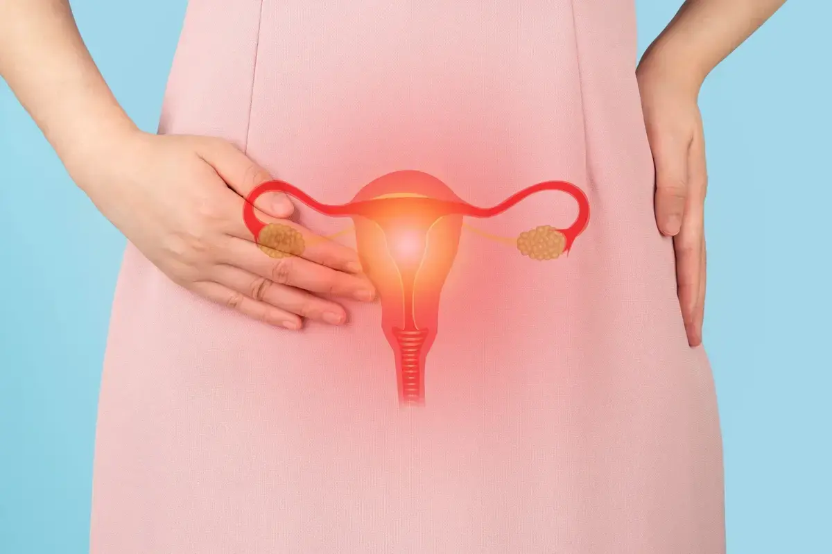 Vitamin D Fails to Improve Endometriosis Symptoms in Recent Study