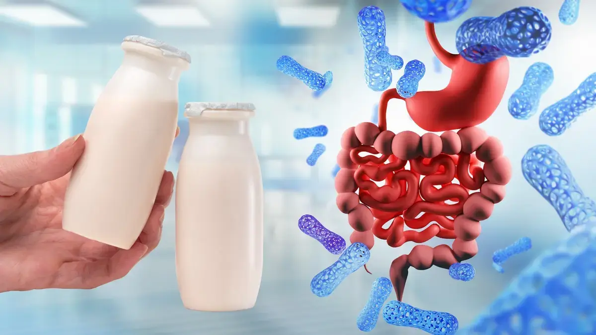 Yogurt and Probiotics May Reduce Colorectal Cancer Risk