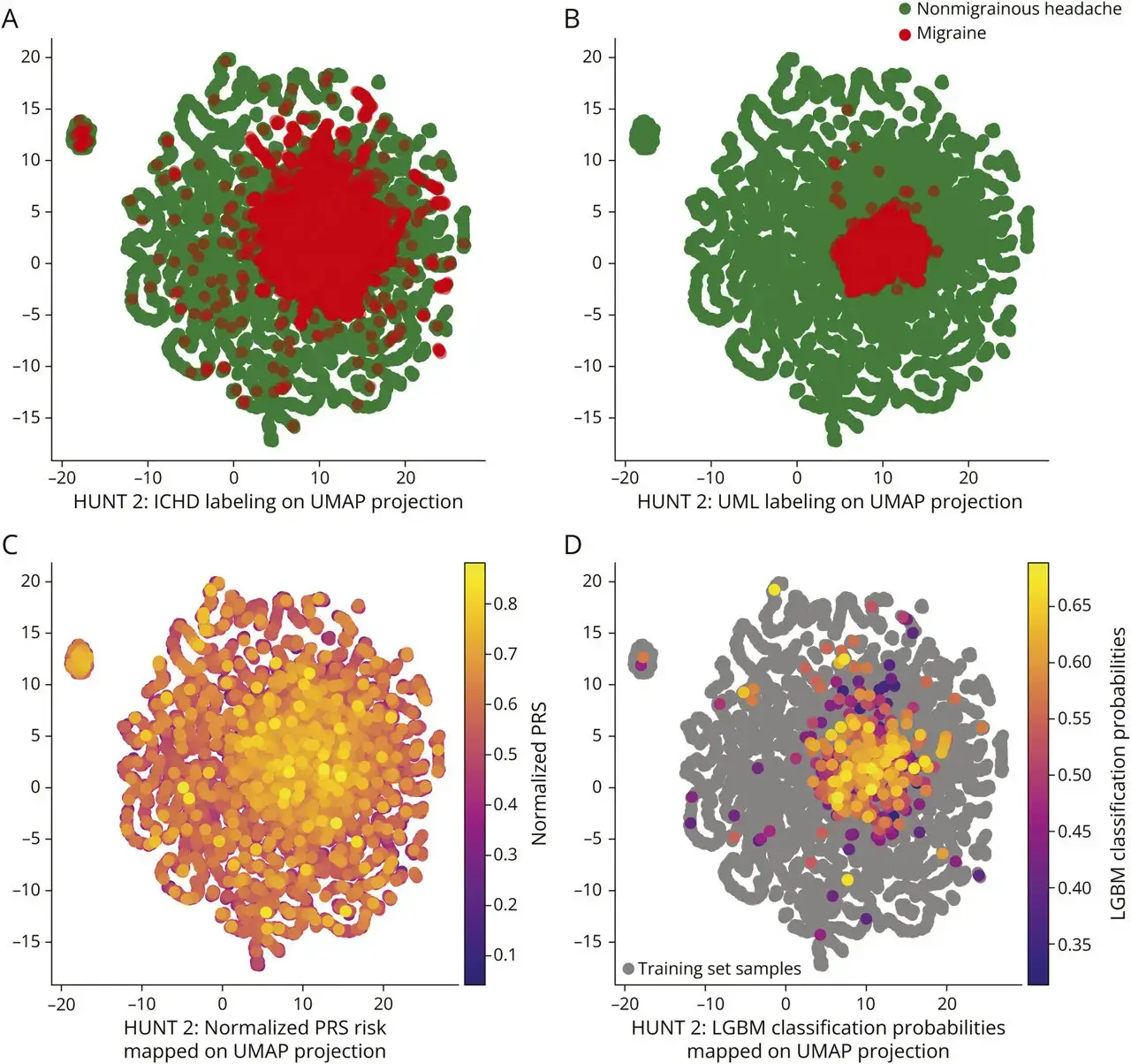 Migraine May Leave Body-Wide Clues, New AI Study Suggests