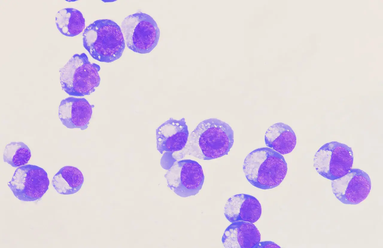 New Therapeutic Target Identified for Sickle Cell and Beta Thalassemia