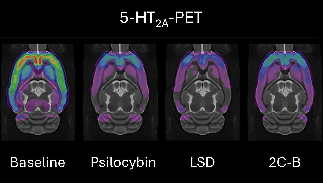 Three psychedelic drugs show distinct brain effects in rat scans