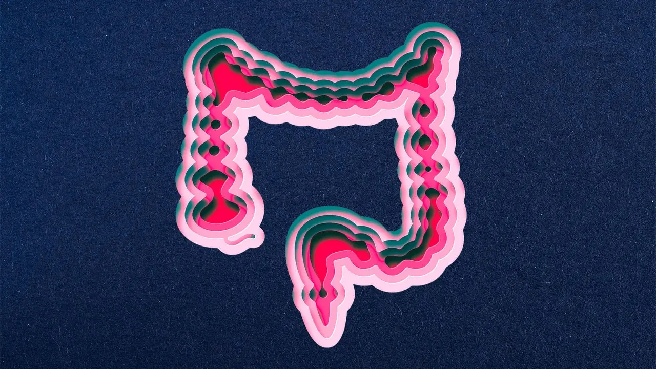 Colon Cancer Rates Climb Across All Age Groups