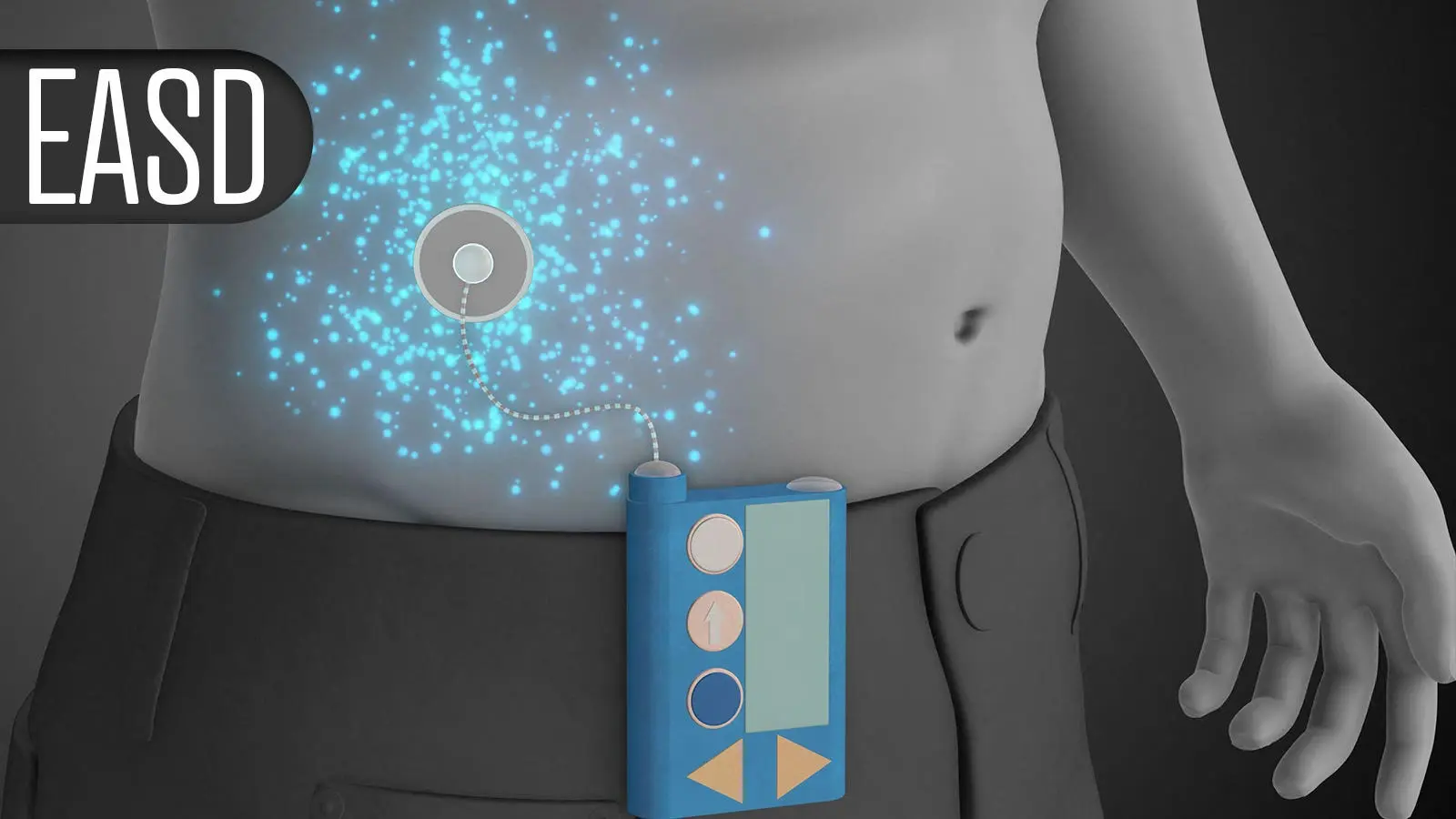 Combo Diabetes Drug Delivers Major Weight Loss in Clinical Trial