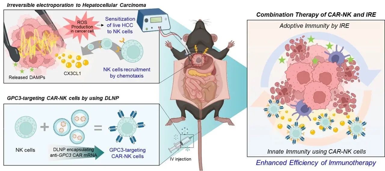 Electrical ablation enhances CAR‑NK cell therapy for liver cancer