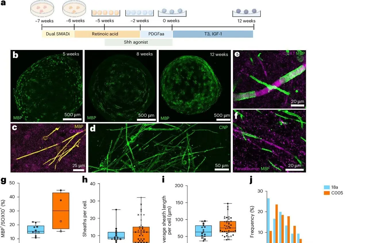 Mini-brains model myelin damage and regeneration for MS drug testing