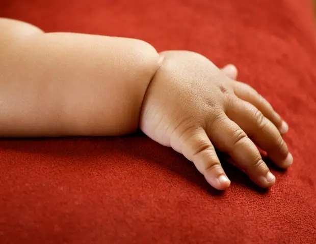 New Global Standard Narrows Childhood Obesity Numbers