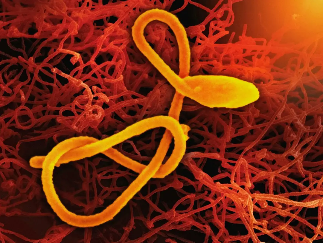 Protein Deficiency Identified as Key Factor in Biological Aging